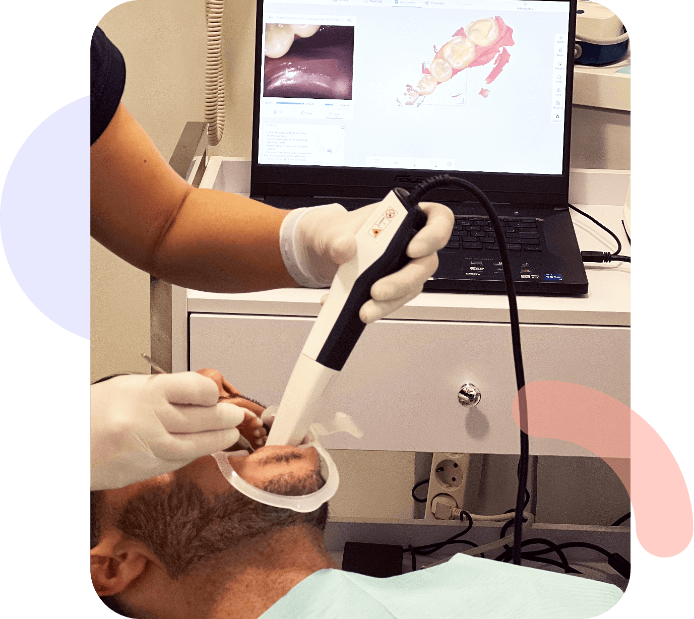 Patient attending a 3D scan appointment for teeth straightening treatment with invisible aligners